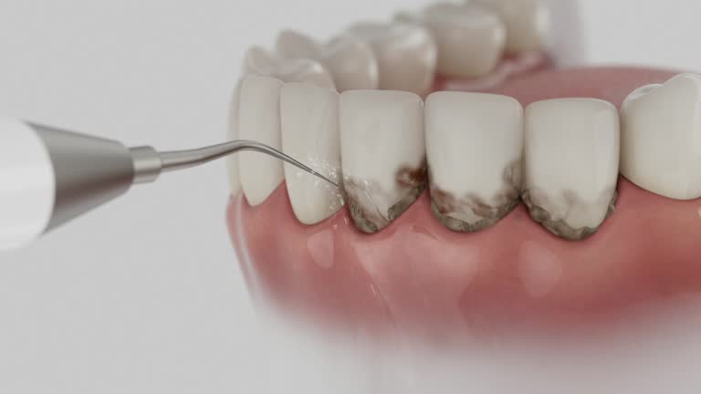 Reliable Dental Implants contractor in Maiden, NC by Smile Center Dentistry